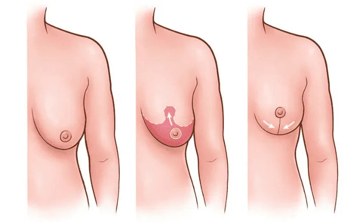 Push-Up Ped™-Sine dikleşdirici